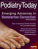Alternative Therapies For Plantar Fasciopathy