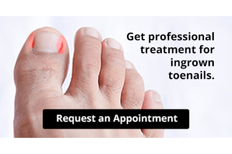 Are You Suffering From Ingrown Toenails
