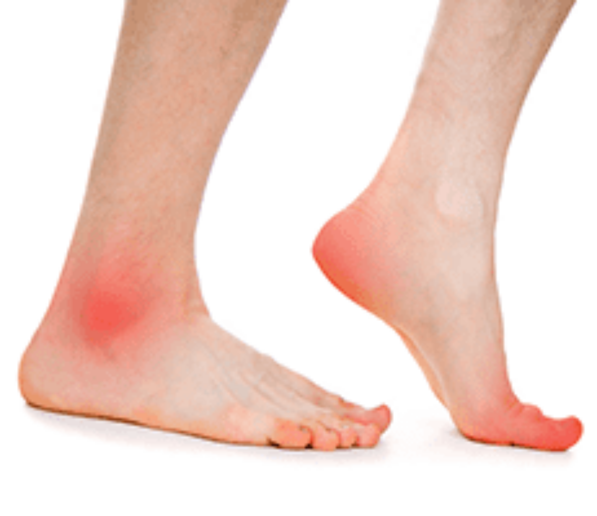 Hallux Rigidus (Big Toe Arthritis) - The Foot and Ankle Clinic