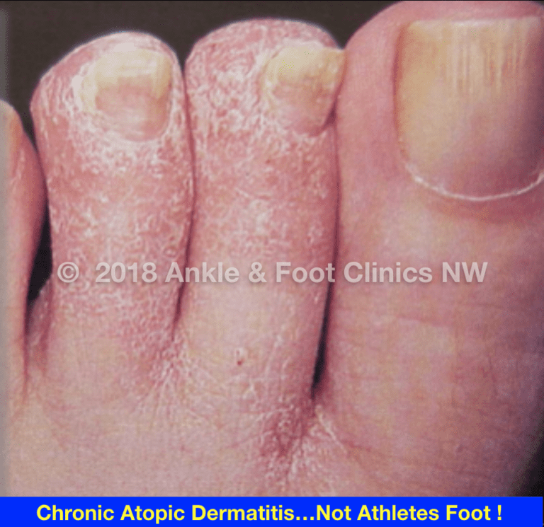 Complex Dermatology Integrative Foot & Ankle Centers of Washington