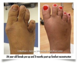 Comprehensive Foot and Ankle Care
