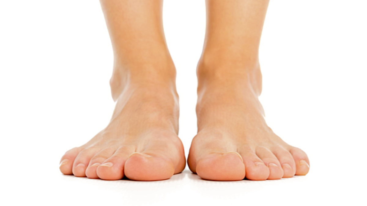 Flat Feet | Foot and Ankle Specialists