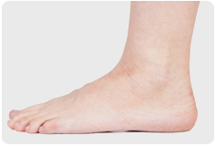 What You Should Know About Flat Feet