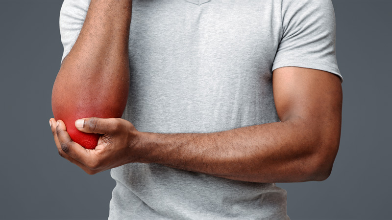 Medial Epicondylitis (Golfer’s Elbow)