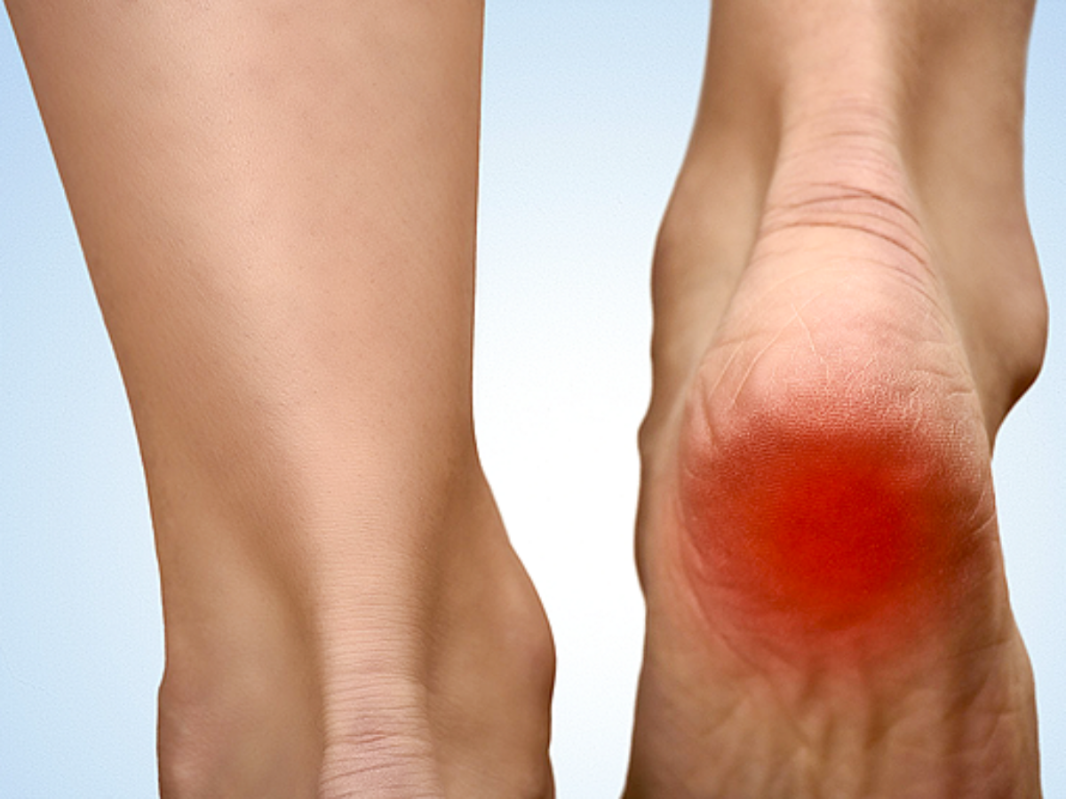Sudden Ankle Pain Without an Injury: Causes and Treatment-totobed.com.vn