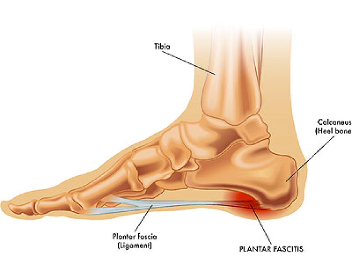 Foot Pain Conditions, Causes, Symptoms, Treatments | HSS