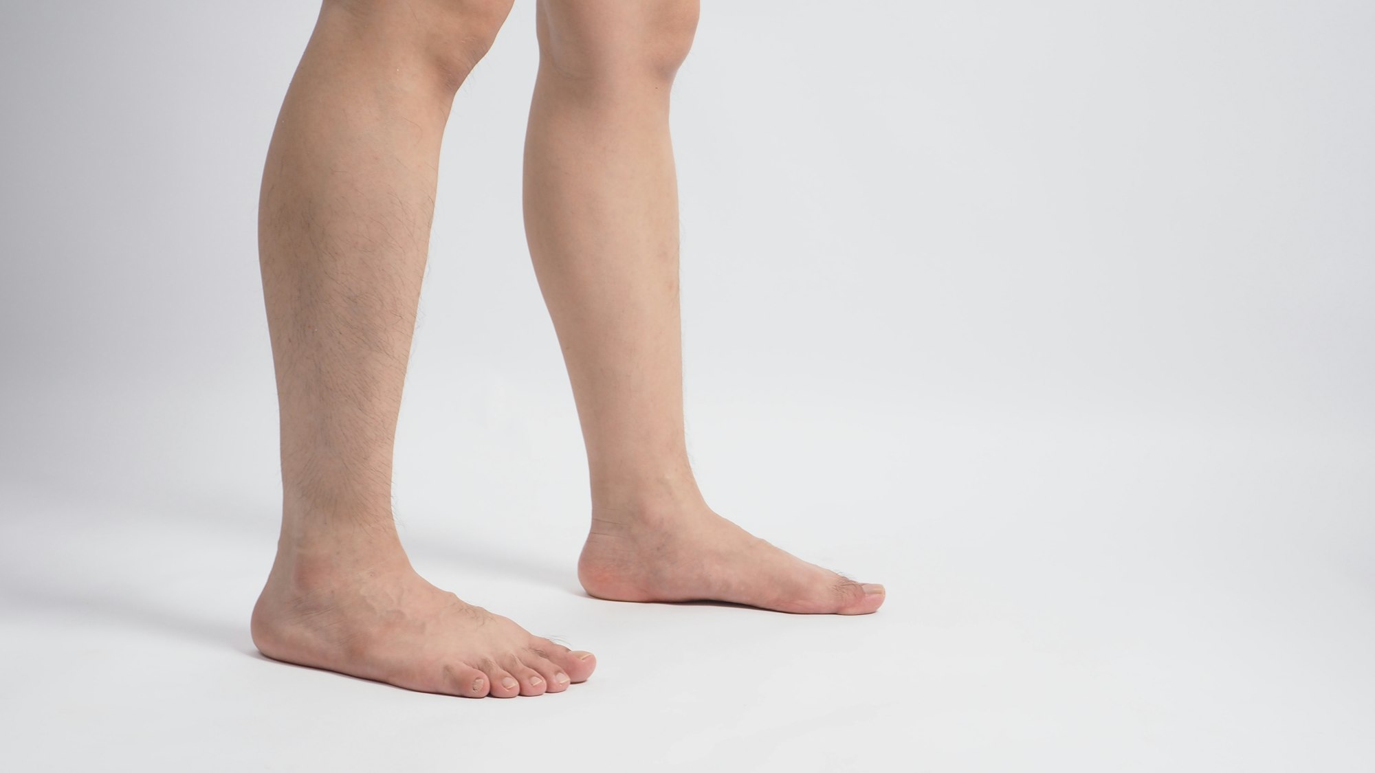 Male barefoot with flat feet