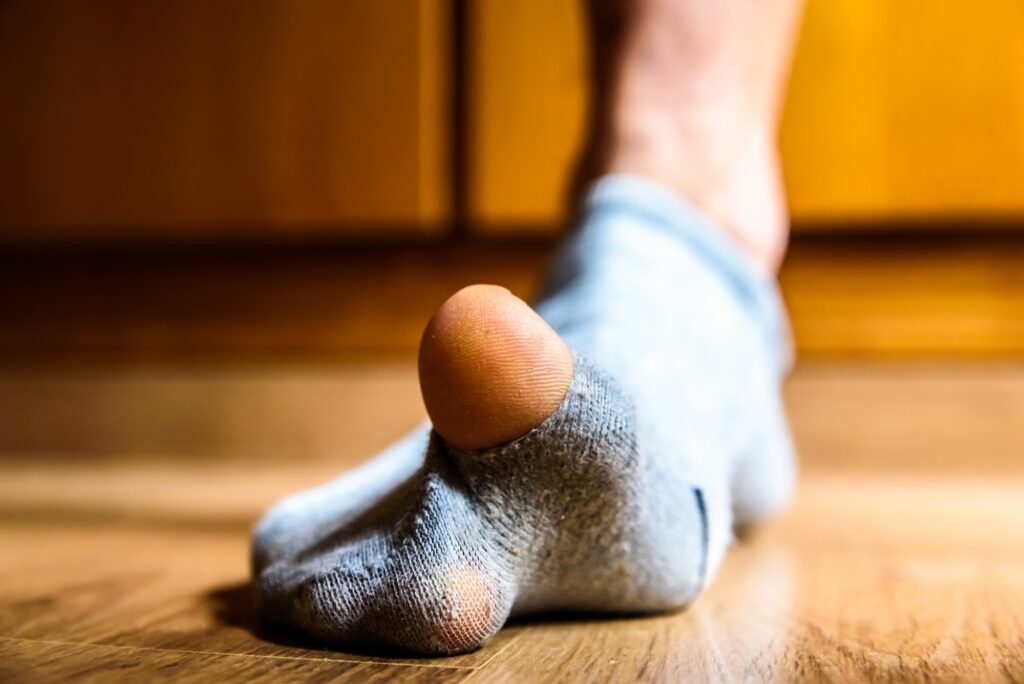 Arthrosurface for hallux limitus