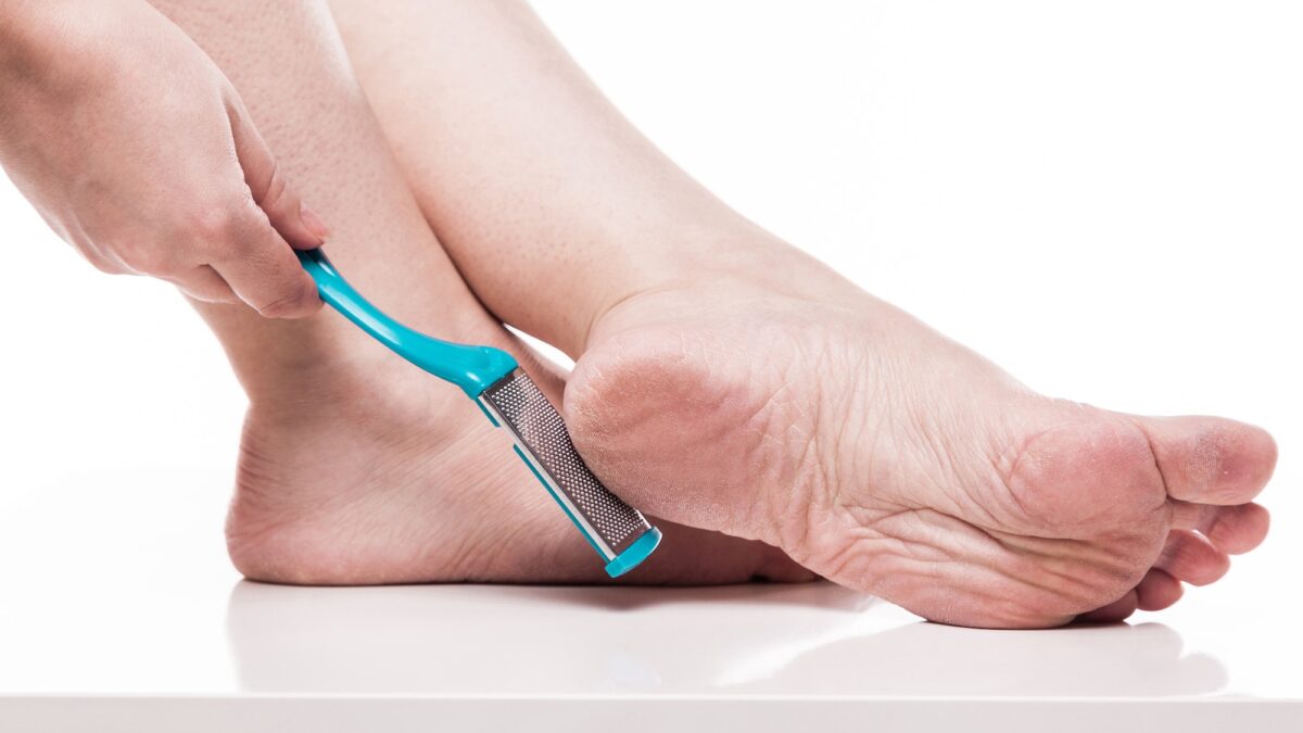 Keep Feet Soft With a Natural Callus Removal Technique - stack