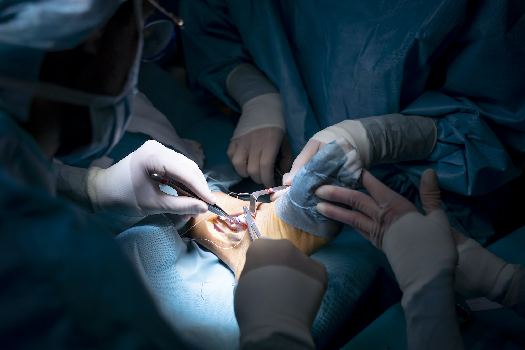 When Is Reconstructive Foot Surgery Recommended?