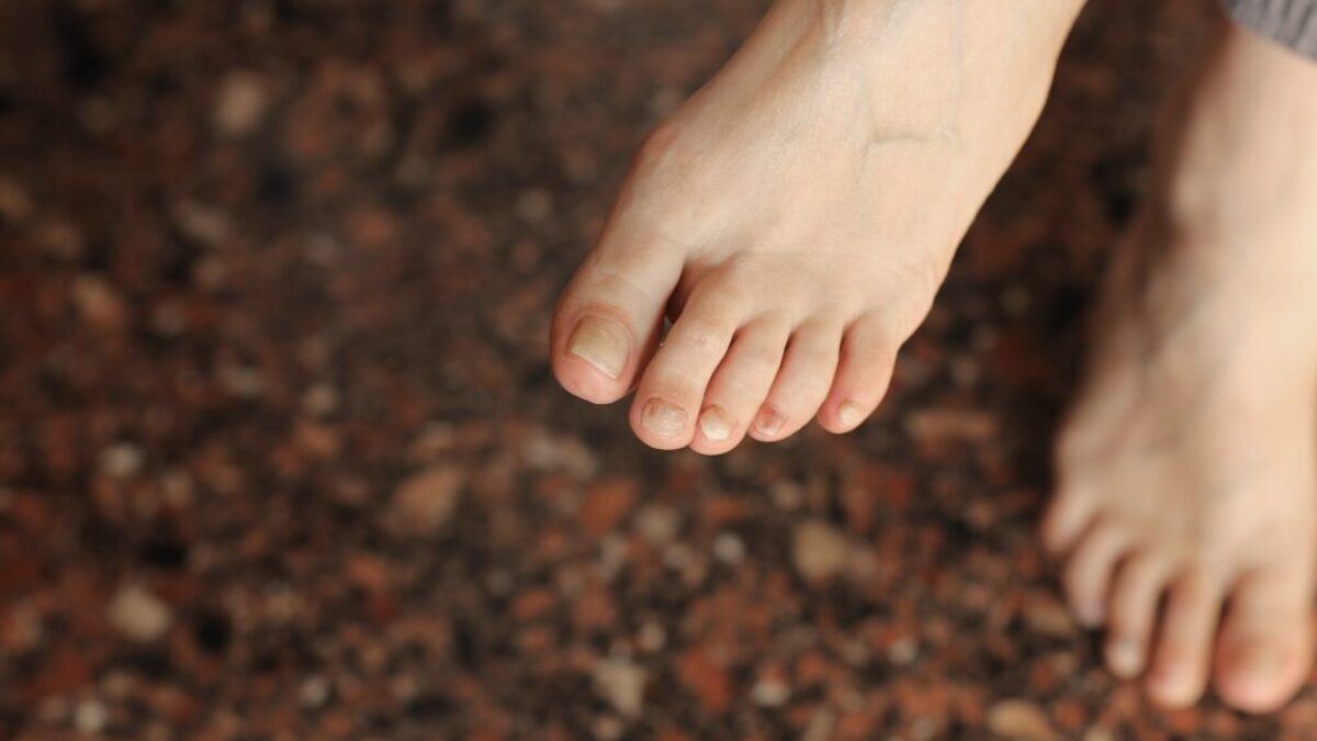 Best Podiatrist Near Me The Foot Doctors of Santa Cruz About