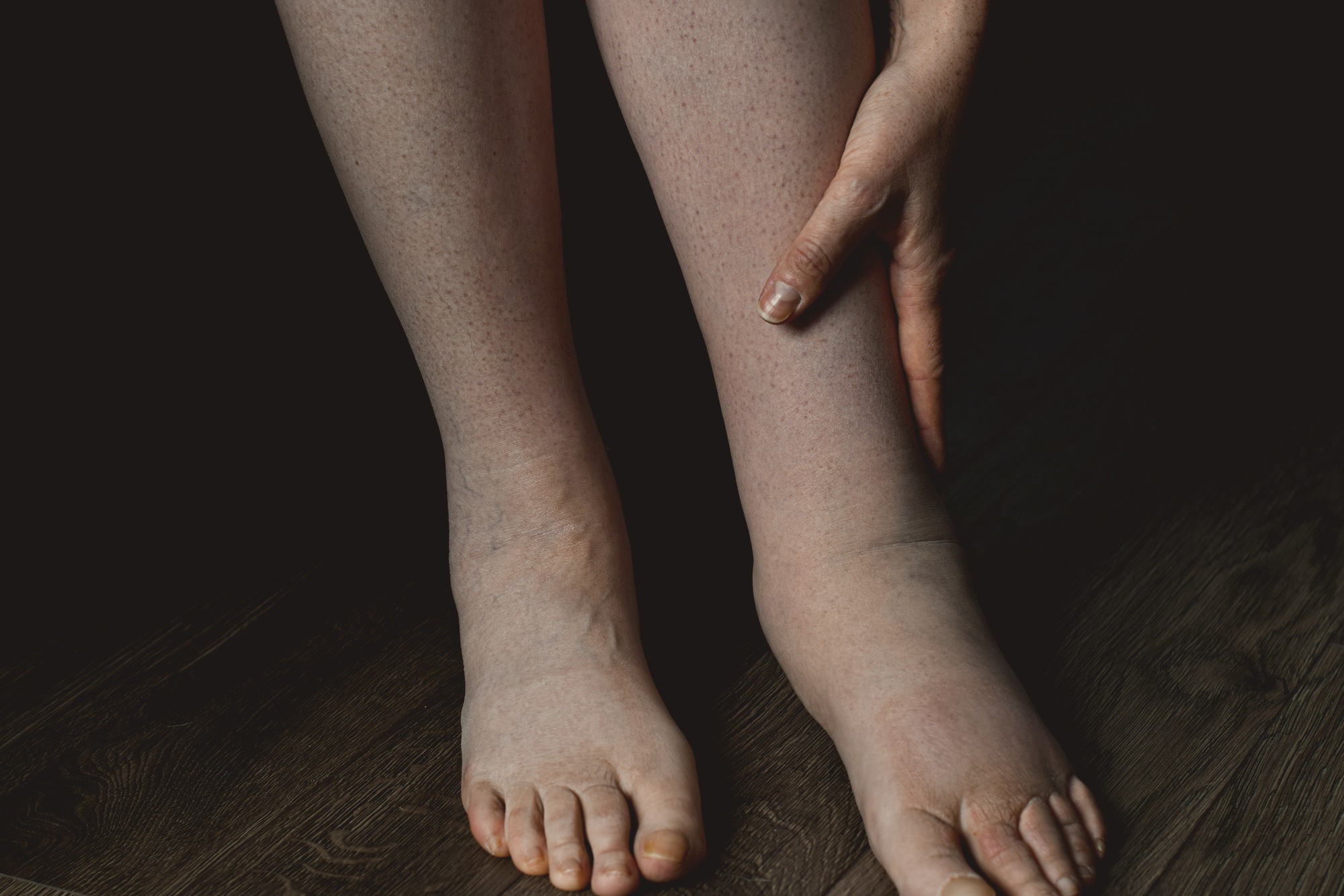 Weil Foot Ankle Institute Elgin IL Weil Foot Ankle Institute Elgin IL
