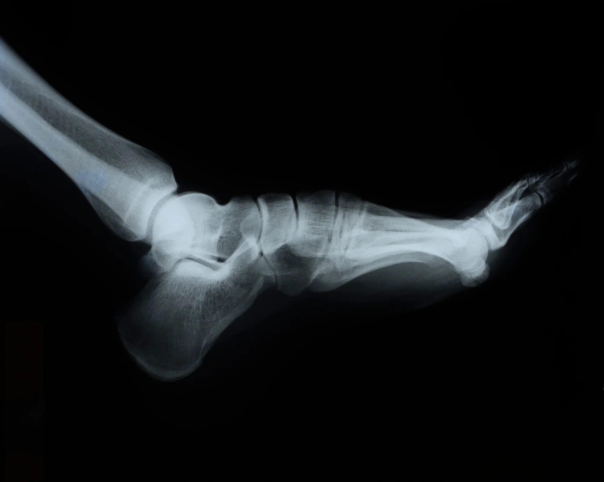 I have bad pain, but nothing is wrong on the x-ray – now what?
