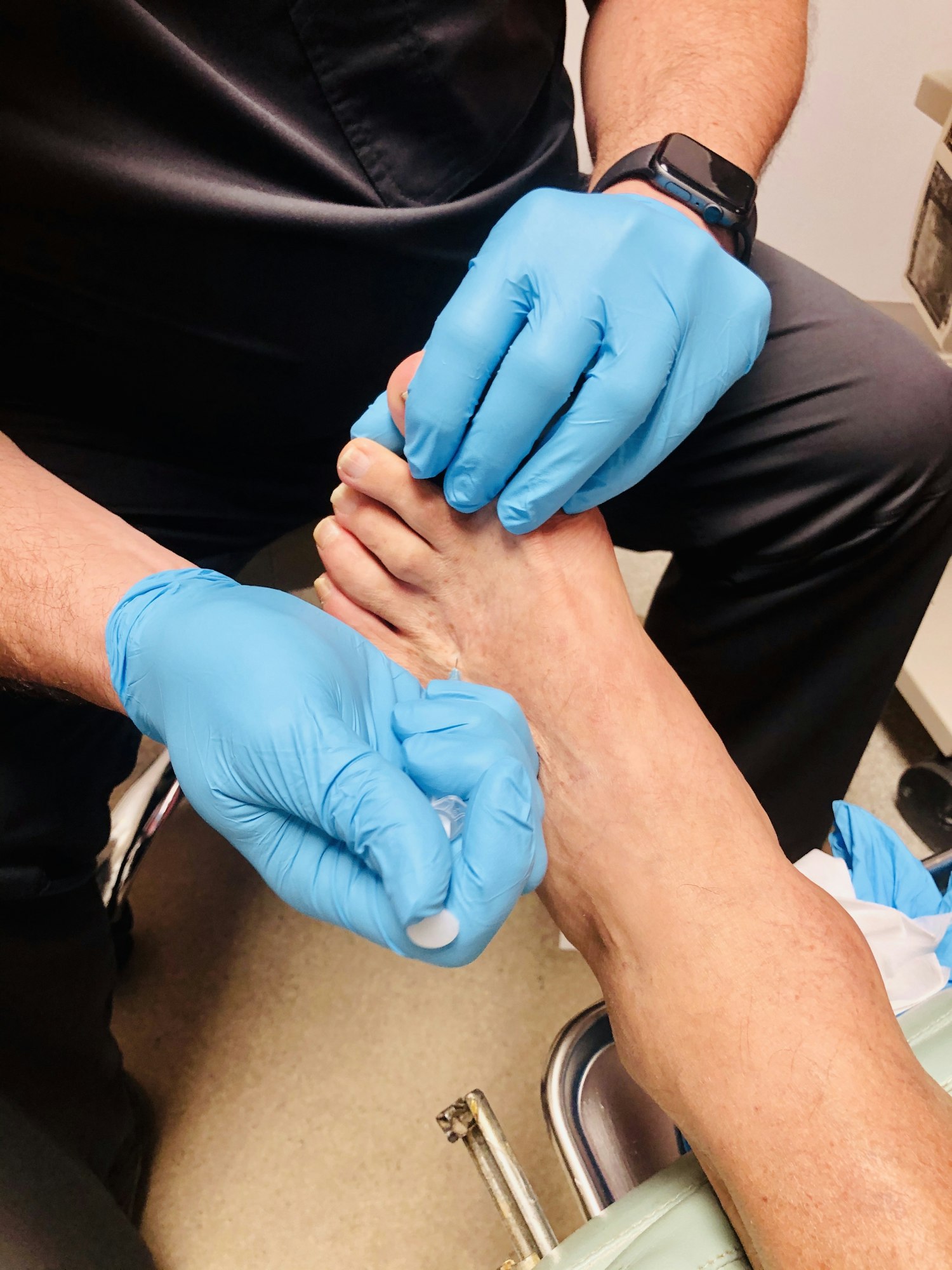 Podiatrist giving a steroid injection into the patient’s foot.