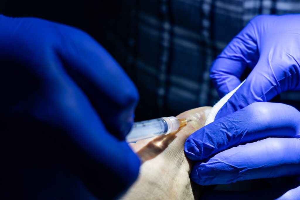 Revision Toe Surgery