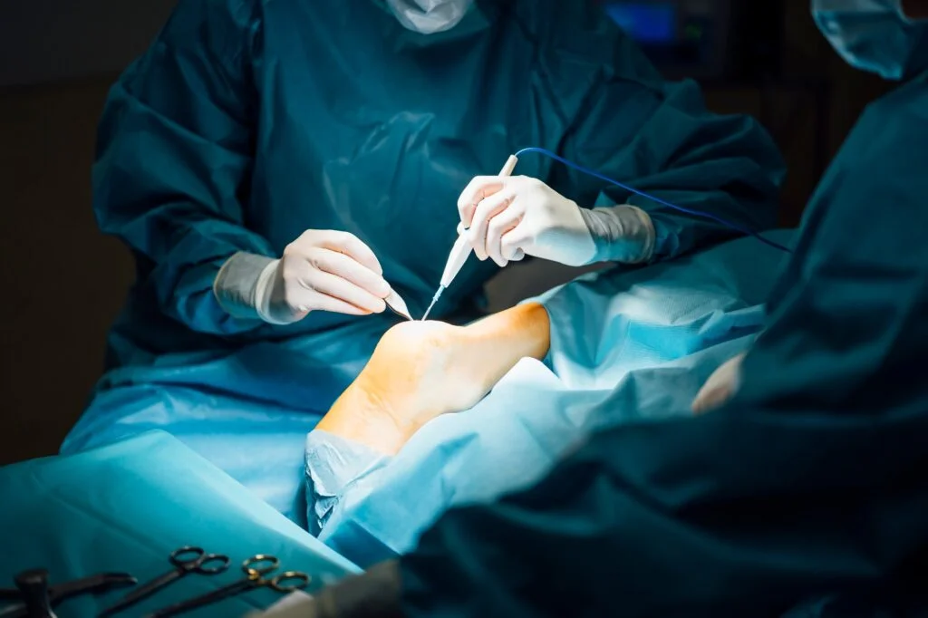 Foot and Ankle Surgery