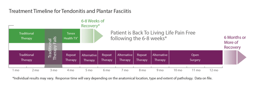Treatment TImeline for Tendonitis and Plantar Fasciitis