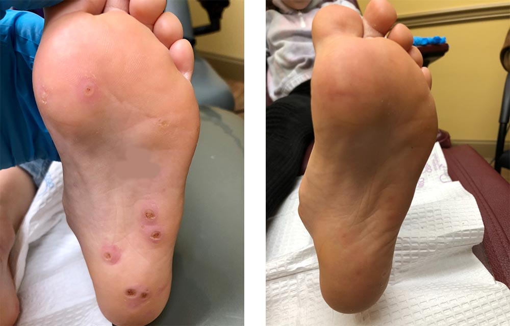 Actual Patient’s Before & After Photos