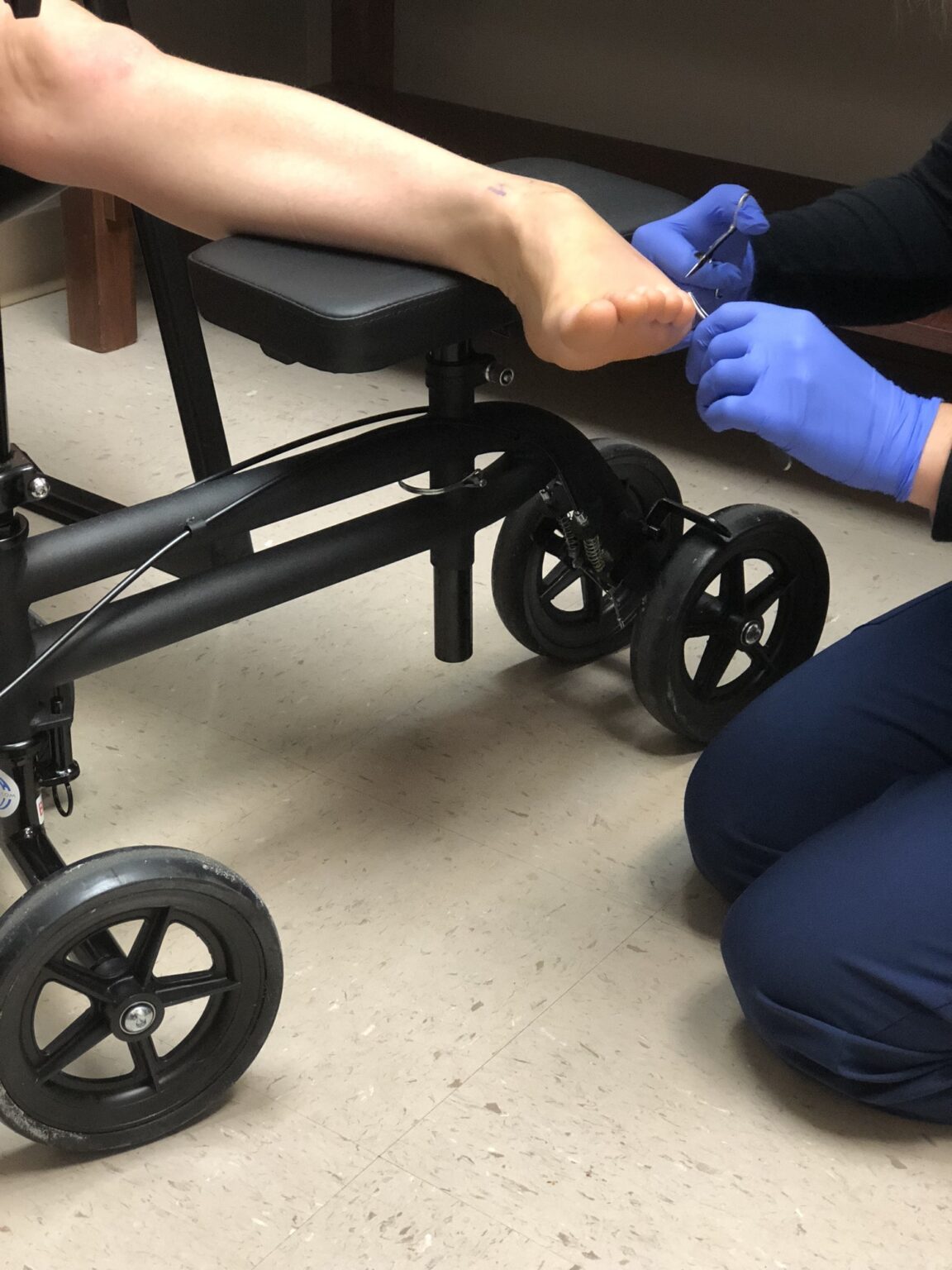 Minimally Invasive Foot Surgery Integrative Foot & Ankle Centers of